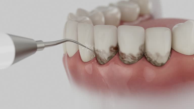 Trusted Teeth Whitening service in Eidson Road, TX - Dentist Open Now
